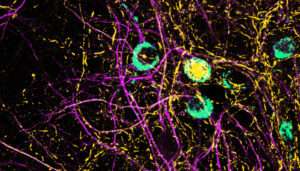 Viral Infections: A Possible Trigger for Neurodegeneration? 3 OrangeNews9 OrangeNews9